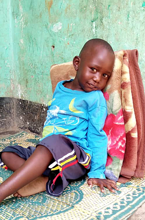 Raphael post-op.jpeg